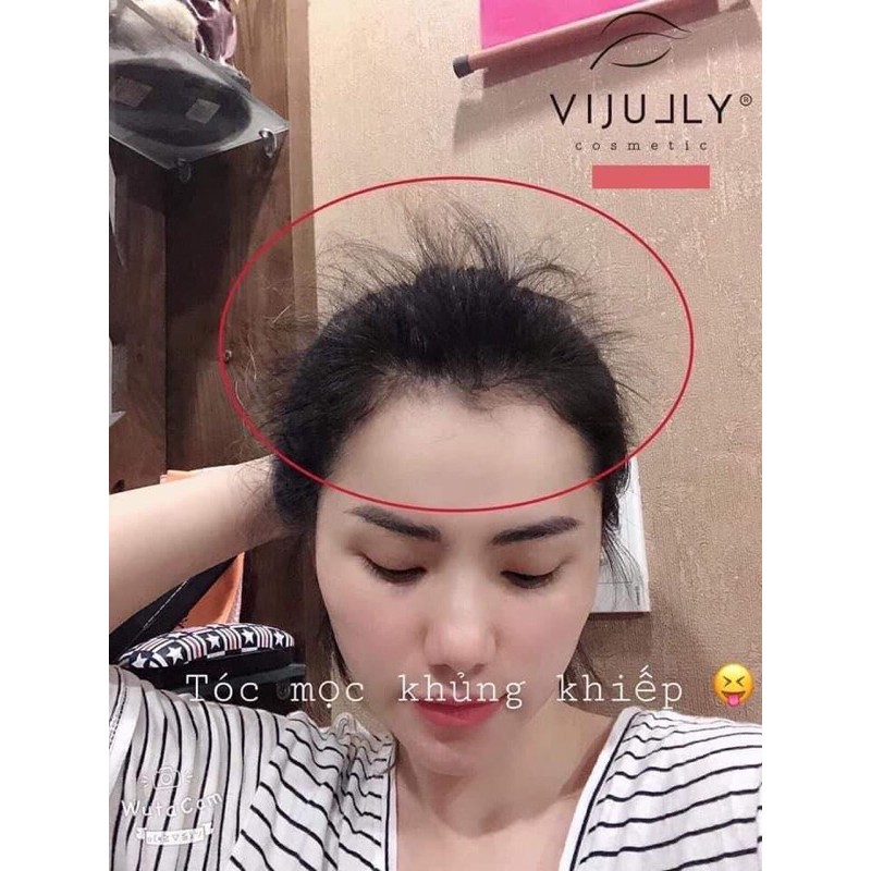 [MỌC TÓC NHANH] TINH DẦU BƯỞI XỊT TÓC VIJULLY 100ml, NGĂN NGỪA RỤNG, KÍCH THÍCH MỌC TÓC