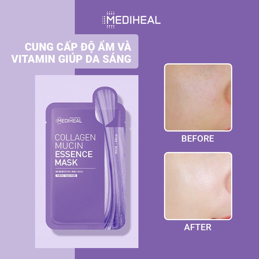 Mặt Nạ Mediheal Giúp Giảm Nếp Nhăn, Ngăn Ngừa Lão Hoá Essence Mask 20ml - Collagen Mucin