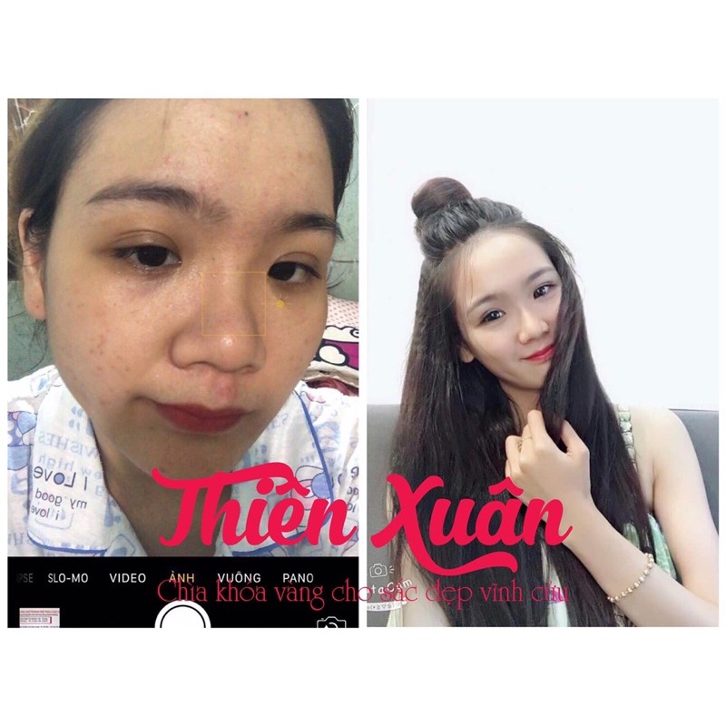 THIÊN XUÂN BỘT UỐNG TRẮNG DA THẦN TỐC TẶNG KÈM SAFFRON | BigBuy360 - bigbuy360.vn