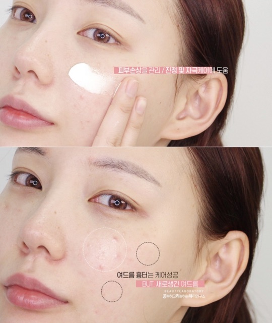 Kem Dưỡng Da Near Skin Trouble Cut Calming Cream Missha 50ml