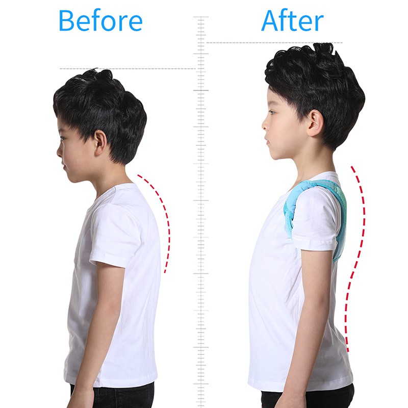 JUNLAIKANG Đai Đeo Hỗ Trợ Chỉnh Sửa Tư Thế Lưng Junlaikang Cho Trẻ Em