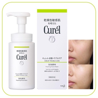 Sữa rửa mặt dạng bọt dành cho da dầu curel sebum trouble care sebum care foaming wash 150ml