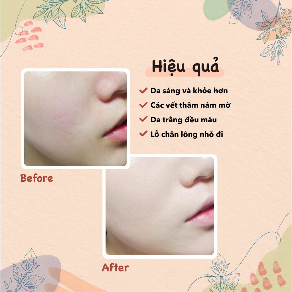 [Mã SKAMLTSW8 giảm 10% đơn 100K] Kem dưỡng trắng da chống nắng Themis Melasma Day Cream | BigBuy360 - bigbuy360.vn