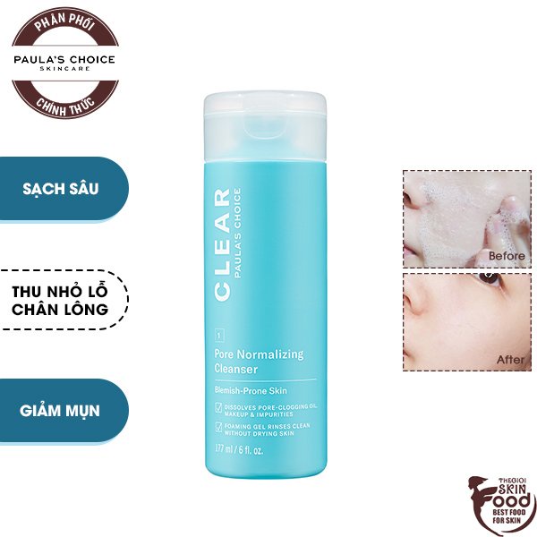 Sữa Rửa Mặt Dành Cho Da Mụn, Thu Nhỏ Lỗ Chân Lông Paula's Choice Clear Pore Normalizing Cleanser 177ml
