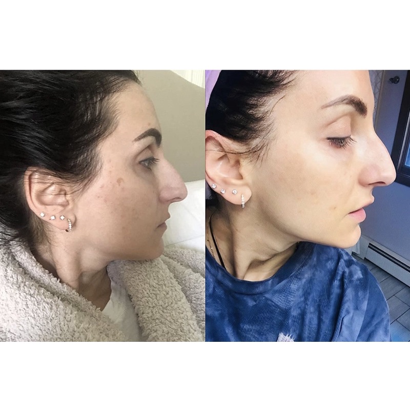 Tinh chất mờ nám đốm nâu Admire My Skin Ultra Potent Brightening Serum
