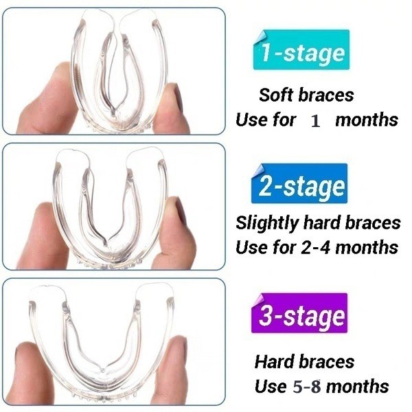 Set 3 Dụng Cụ Niềng Răng Vô Hình Dành Cho Người Lớn / Trẻ Em
