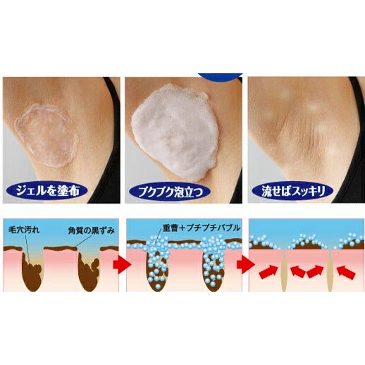 Bill Nhật 🌸 Kem Dưỡng Chống Thâm Vùng Nách PUKKU PUKU BUBBLE SODA PACK Nhật Bản