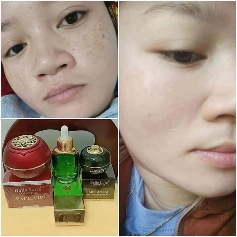 Kem Face Vip Balla Luta Thu Hằng - Face Vip Đỏ Balla Luta 30gr Chính hãng