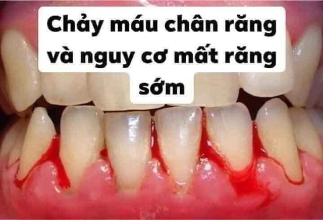 Gói dùng thử 100g bột đánh trắng răng hoa linh (now ship 0đ)