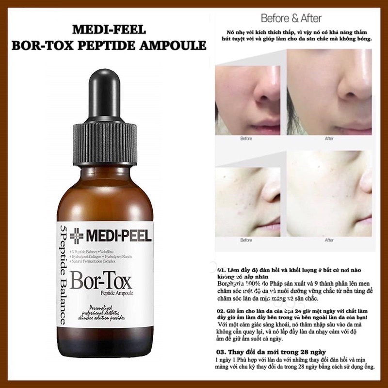 Serum Căng Bóng Trắng Da Bor tox Medi Peel Se Khít lỗ chân lông