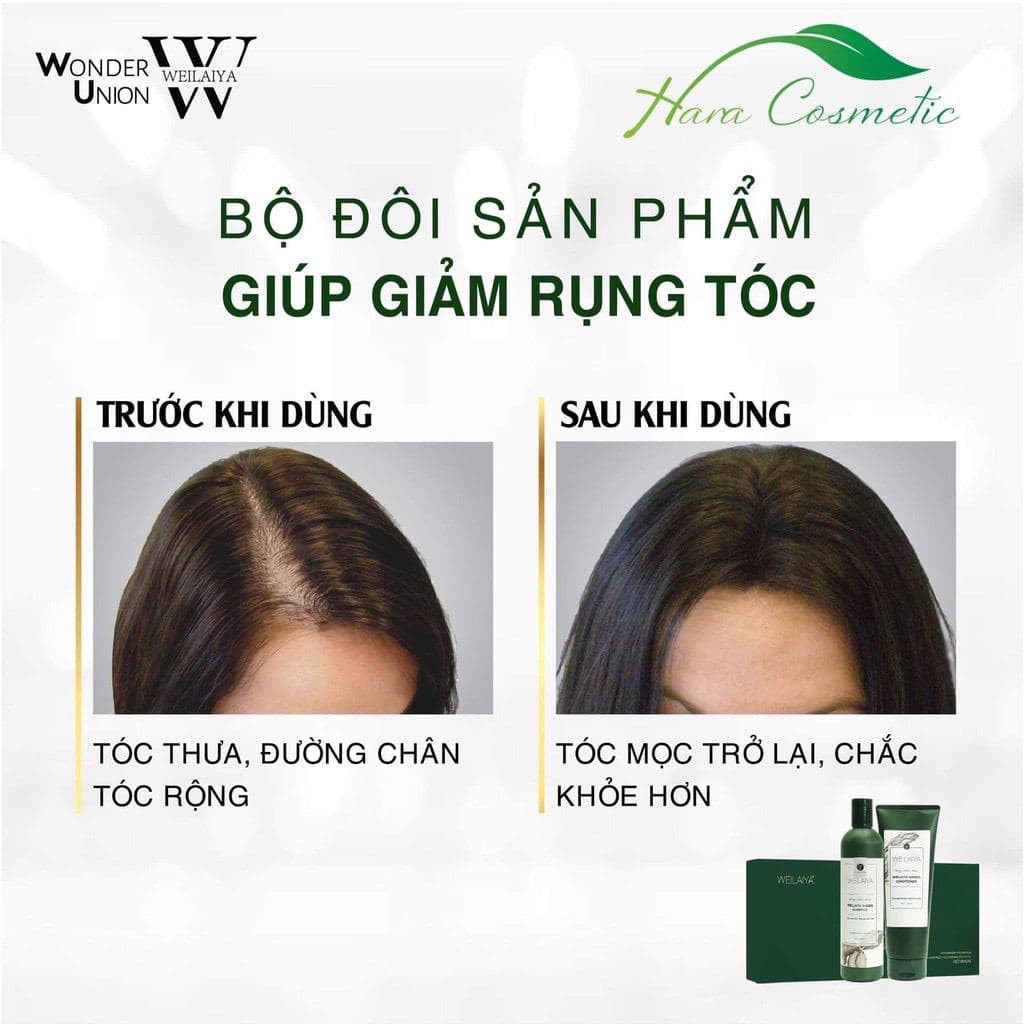 Bộ Dầu Gội Xả Gừng & Gừng Thuốc Bắc | BigBuy360 - bigbuy360.vn