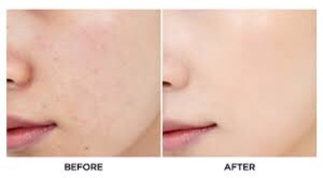 [Cam kết chính hãng] Che Khuyết Điểm CLIO Kill COVER LIQUID CONCEALER | BigBuy360 - bigbuy360.vn