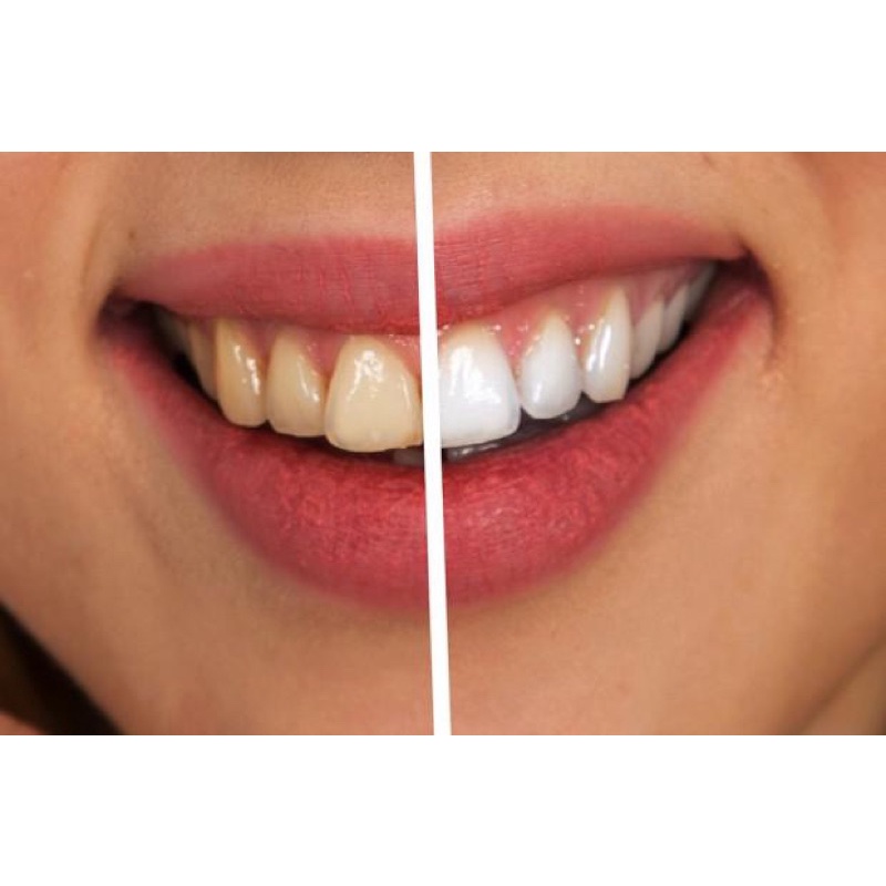 Kem đánh răng y tế Ajona Đức 25ml, chống hôi miệng, chống tạo vôi răng, mảng bám, chống sâu răng, bệnh nha chu
