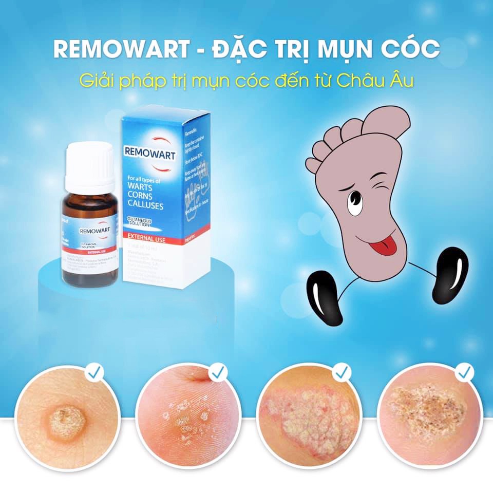 Dung dịch bôi hỗ trợ các loại mụn cóc, chai sần ở chân Remowart Lọ 10ml