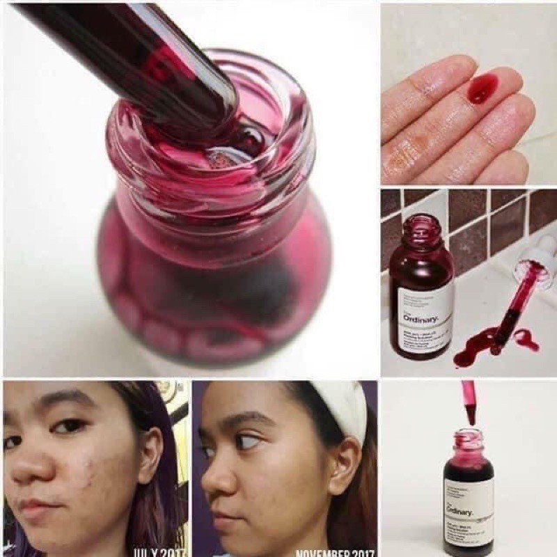 SERUM TDC THE ORDINARY AHA 30% + BHA 2% 30ML | BigBuy360 - bigbuy360.vn