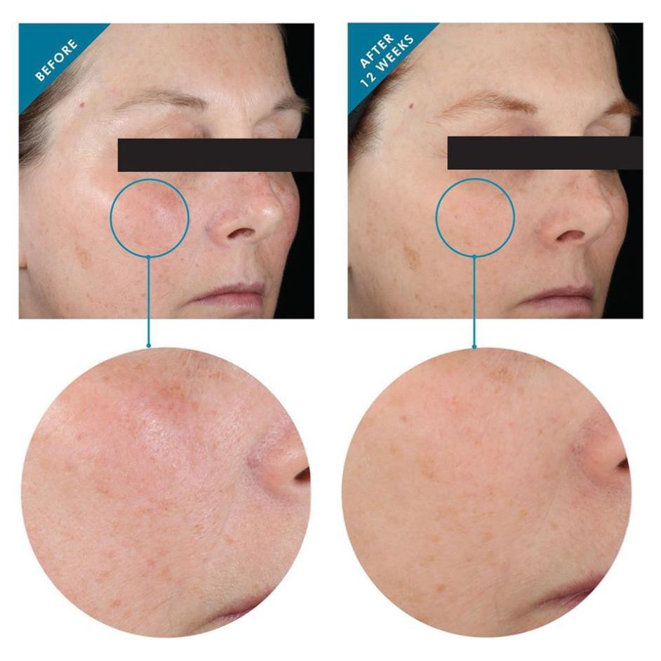 Serum Skiinceuticals Hydrating B5 Minisize 4ml - 30ml