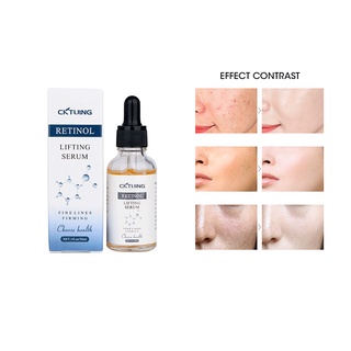[Hàng mới về] Huyết thanh Retinol CKTUING làm sáng và dưỡng ẩm 30ml