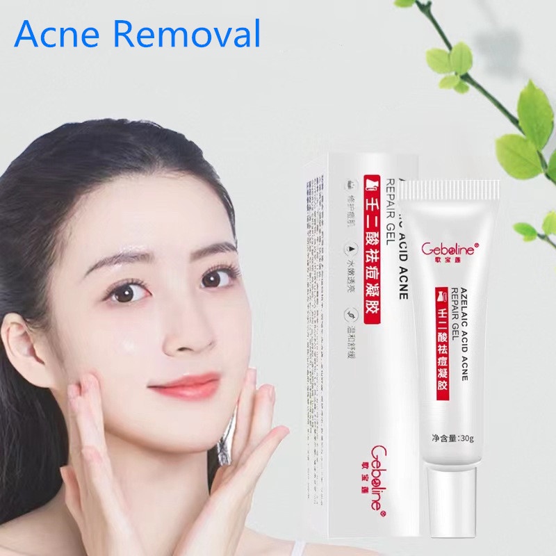 Kem Hỗ trợ giảm mụn 15% Axit Azelaic Tự Nhiên Dưỡng Ẩm Phục Hồi Da M171