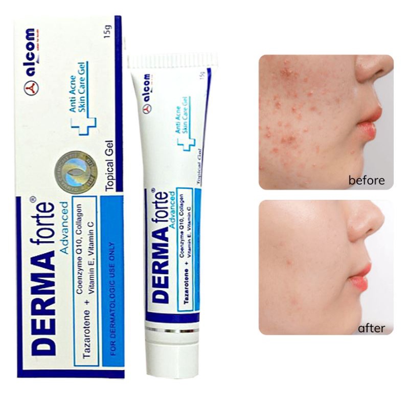 Derma Forte Chính Hãng Gel Giảm Mụn, Kem Mờ Sẹo, Giảm Thâm Dưỡng Da