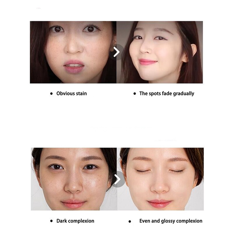 Kem Dưỡng Trắng Da Xóa Mờ Sạm Nám Tàn Nhang