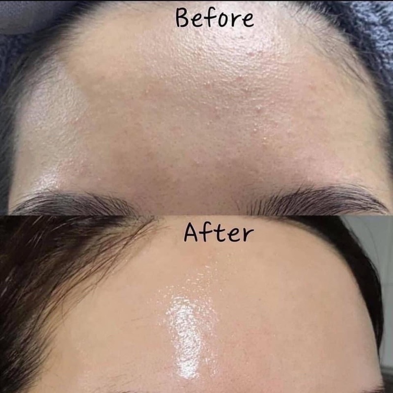 [FREE SHIP] Serum Dưỡng Da Cấp Ẩn Phục Hồi B5 Goodndoc