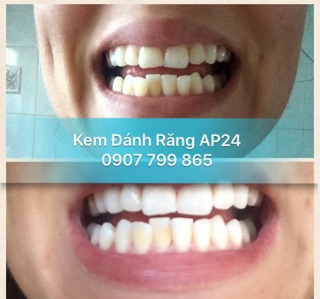 Kem Đánh Răng AP24 Ban Đêm