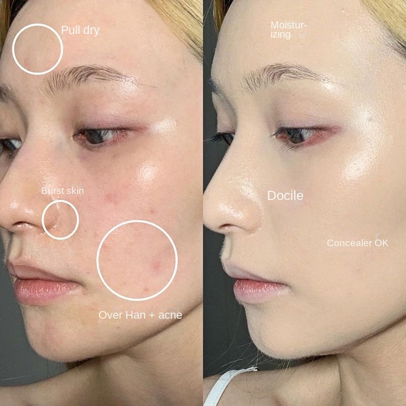 Kem Che Khuyết Điểm 3 Màu Xiao Yumi Che Phủ Mụn Quầng Thâm Mắt Và Mặt