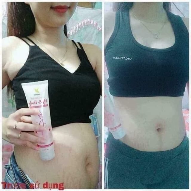 Gel tan mỡ gừng quế vy&body