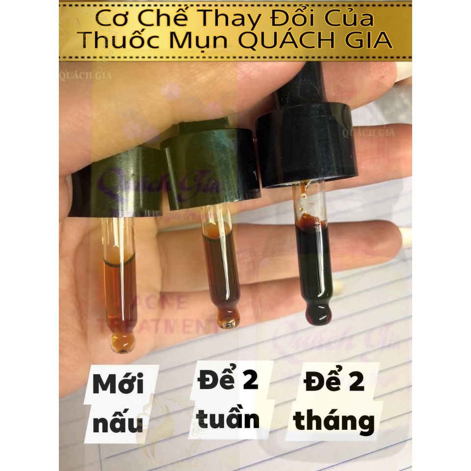 Chai Mụn Gia Truyền Quách Gia 5ml