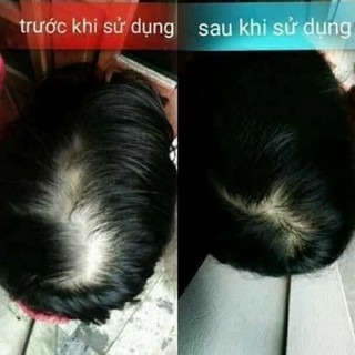 Dầu gội Thanh mộc hương