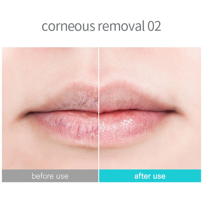 Tẩy tế bào chết môi SOONNOC Bubble Lip Cleanser 15g Gomimall
