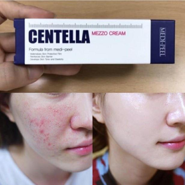 Kem Ngừa Mụn Rau Má Medi-Peel Centella Mezzo Cream - Medi Peel