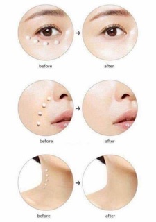 Kem mắt ahc