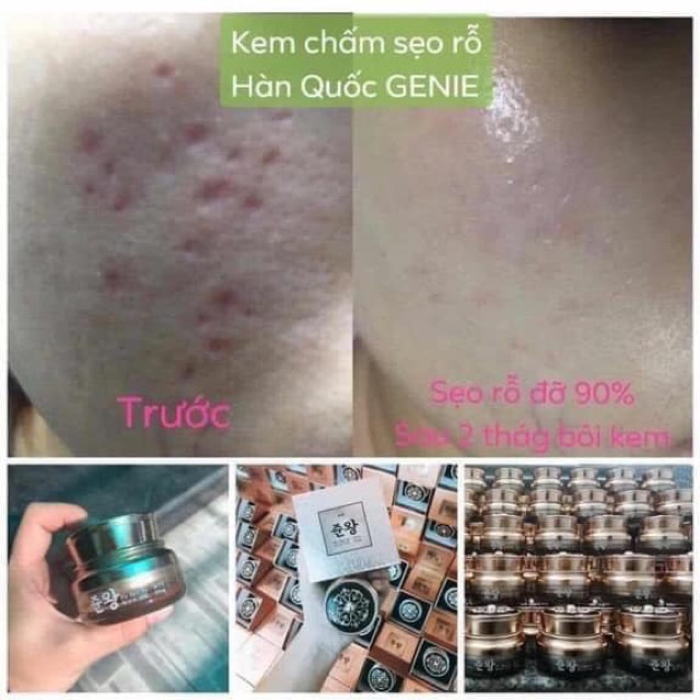 Kem tri seo rỗ đông y