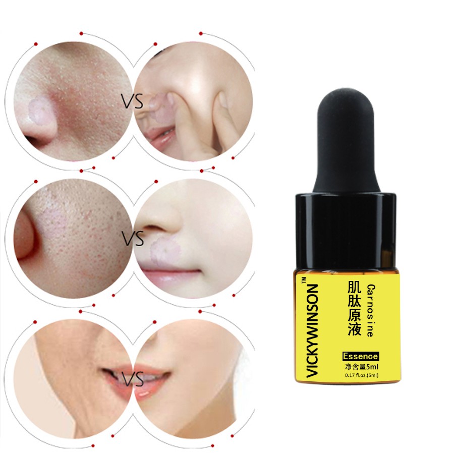 Serum Carnosine 5ml làm trắng da chống lão hóa và Hỗ trợ giảm mụn