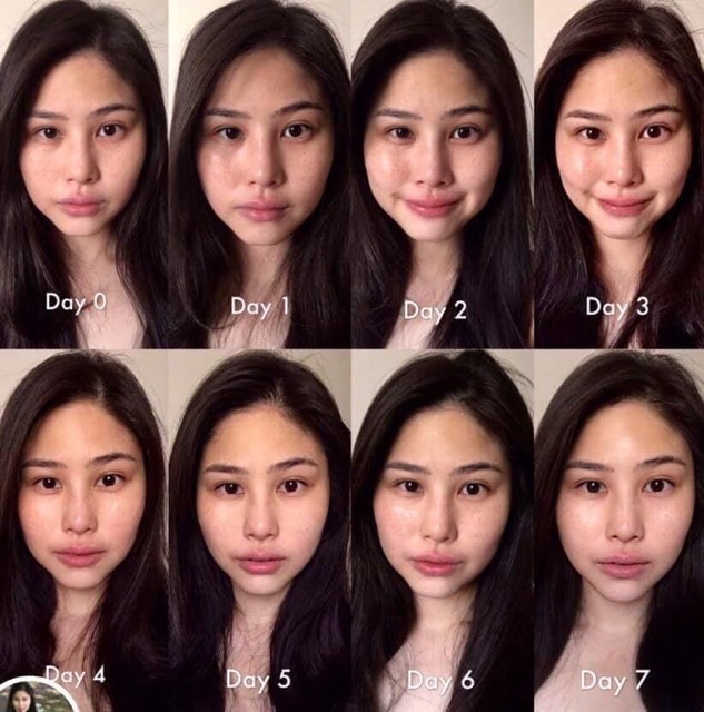 Có xem bill🇺🇸 Tách set chăm sóc da Clinique Skincare TLC kit sáp tẩy trang, vitamin C, kem dưỡng ẩm