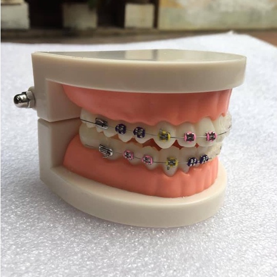 Mô hình tư vấn nha khoa,tư vấn các bênh lý hở cổ chân răng,viêm tuỷ,sâu răng