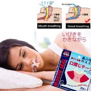 Set 30 miếng dán chống ngáy khi ngủ tiện dụng