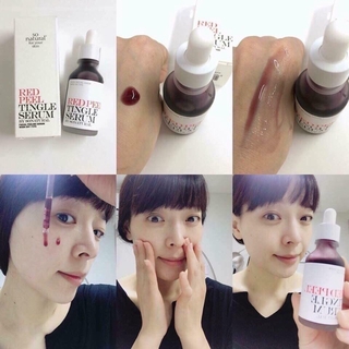 Serum Red Peel Tingle 25ml