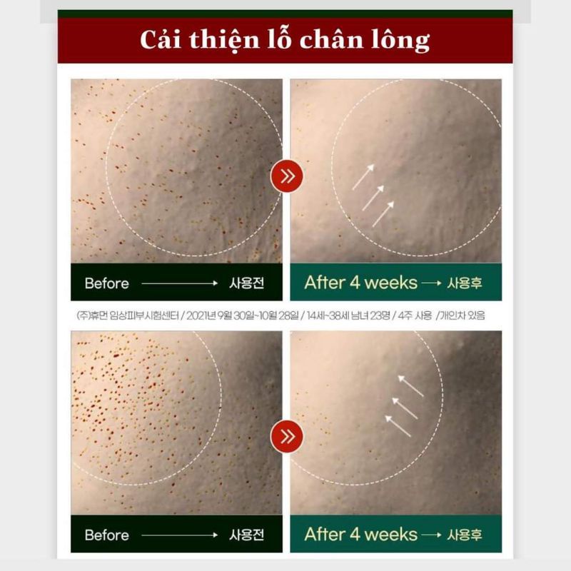 Kem dưỡng All Green Tox Solution của MEDIPICKME 50ML