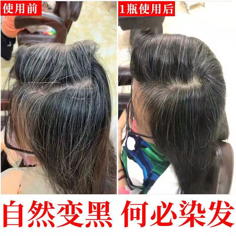 Tinh Chất Thảo Dược Tự Nhiên Ngăn Rụng Tóc Giúp Tóc Đen Trắng 100ML