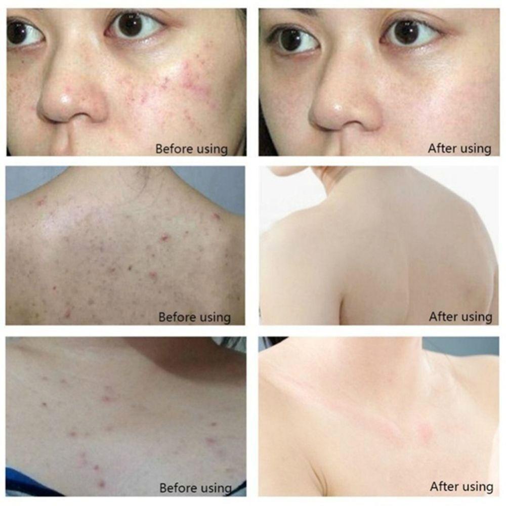 Xà Phòng Handmade Kháng Khuẩn Kiềm Dầu Làm Sạch Và Trắng Da Toàn Thân