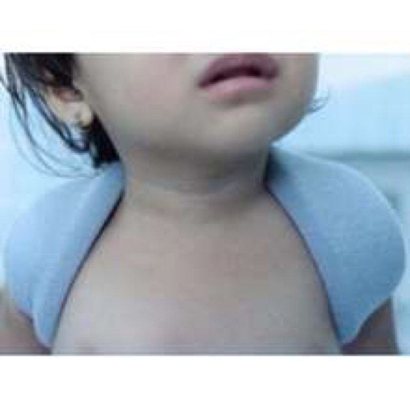 ❤ Đai số 8 (Đai xương đòn) trẻ em orbe, đai xương đòn bả vai trẻ em Orbe các số, đai xương đòn size nhỏ cho bé Orbe