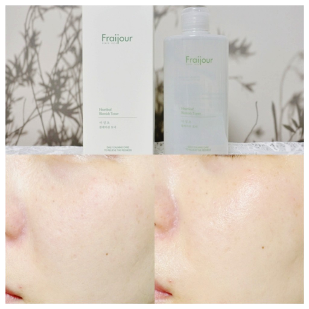 Toner Diếp Cá FRAIJOUR Làm Sạch Mụn Đầu Đen Heartleaf Blemish Toner Làm Dịu Da Cấp Ẩm