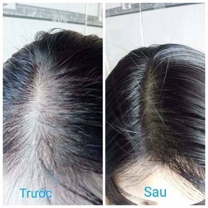 [Chính Hãng] Xịt dưỡng tóc Amla Hair Reborn Laco ⚡ Tạo độ phồng, dưỡng ẩm tóc, nước hoa cho tóc, giúp tóc chắc khỏe