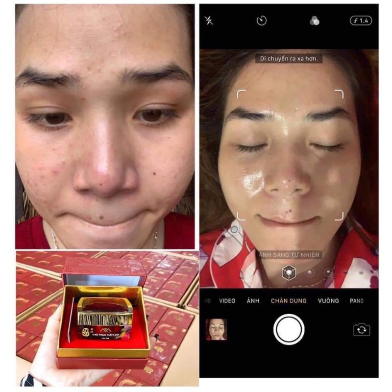 [ Chính Hãng 100% ] Cao Mụn Sâm Đỏ 36vị Đông Y full size | BigBuy360 - bigbuy360.vn