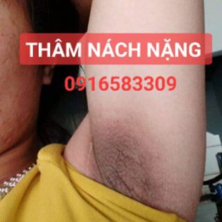 PEEL TCA CHẤM DỨT THÂM NÁCH