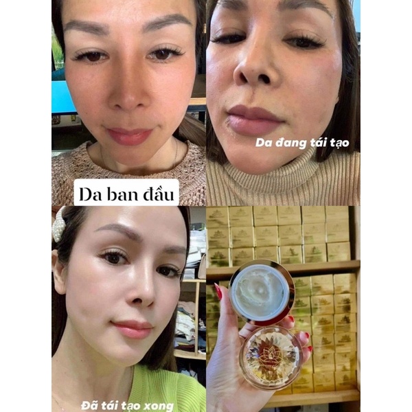 Kem tái tạo chamomileskill