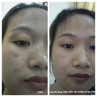 Tinh chất Ngọc Thiên Hương
