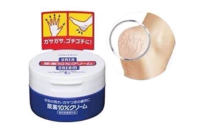 Kem trị nẻ gót chân tay Shisheido Urea cream